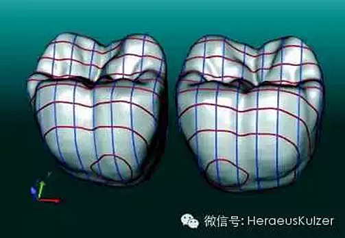 )RAWW7BL[JCP[061ICXIFGN.png )RAWW7BL[JCP[061ICXIFGN.png