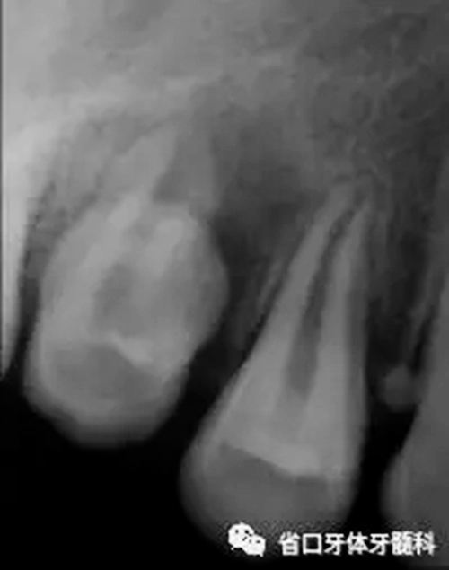 2.webp.jpg 2.webp.jpg