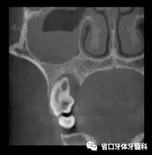 3.webp.jpg 3.webp.jpg