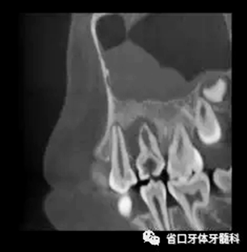 4.webp.jpg 4.webp.jpg