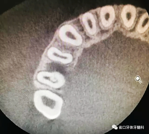 5.webp.jpg 5.webp.jpg