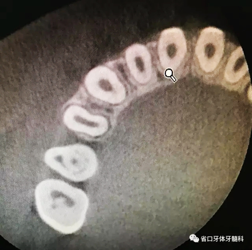 6.webp.jpg 6.webp.jpg