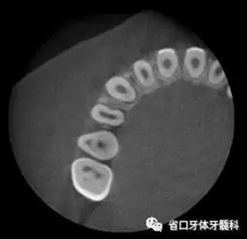 11.webp.jpg 11.webp.jpg