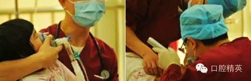 全麻下兒科治療+兒牙樹脂充填 全麻下兒科治療+兒牙樹脂充填