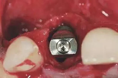 6.webp.jpg 6.webp.jpg