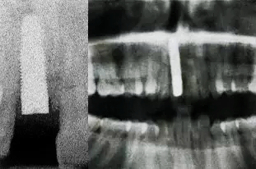 11.webp.jpg 11.webp.jpg