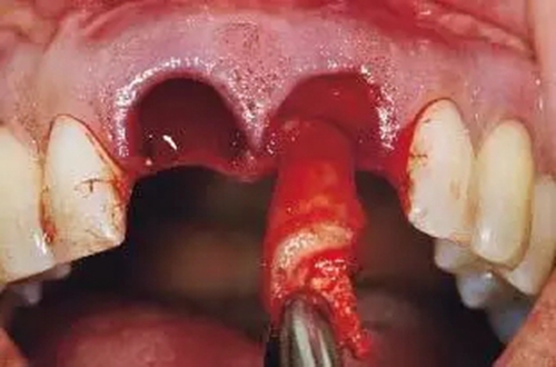 16.webp.jpg 16.webp.jpg