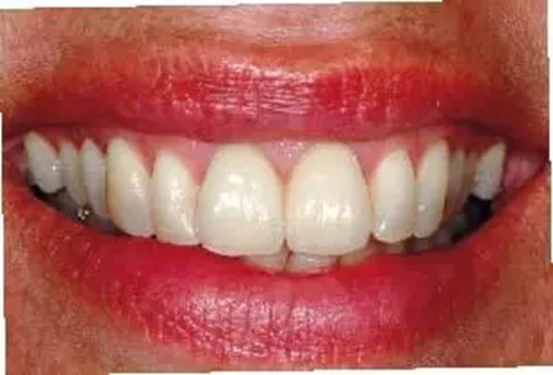 28.webp.jpg 28.webp.jpg