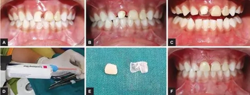 3.webp.jpg 3.webp.jpg