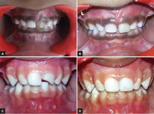 2.webp.jpg 2.webp.jpg