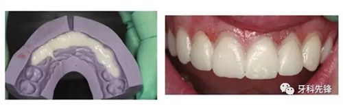 5.webp.jpg 5.webp.jpg