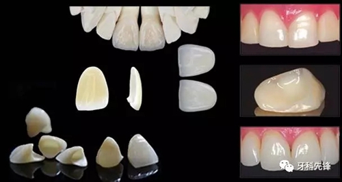 6.webp.jpg 6.webp.jpg