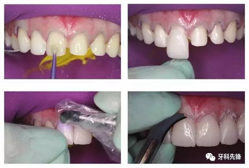 10.webp.jpg 10.webp.jpg