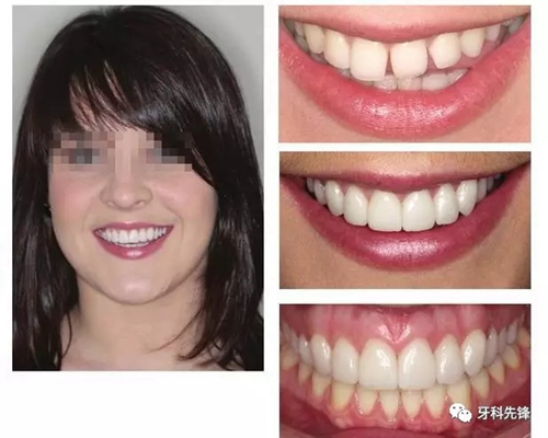 11.webp.jpg 11.webp.jpg