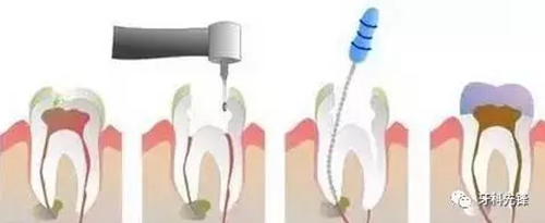 4.webp.jpg 4.webp.jpg