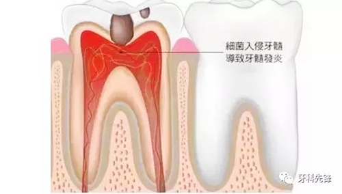 3.webp.jpg 3.webp.jpg