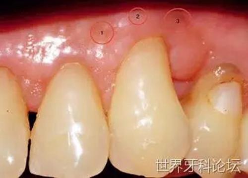 5.webp.jpg 5.webp.jpg