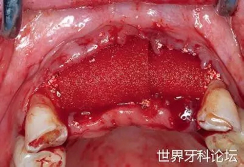 17.webp_副本.jpg 17.webp_副本.jpg