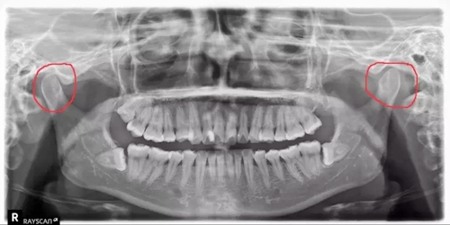 1.webp.jpg 1.webp.jpg