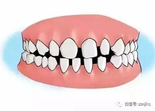 2.webp.jpg 2.webp.jpg