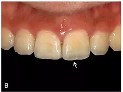 6.webp.jpg 6.webp.jpg