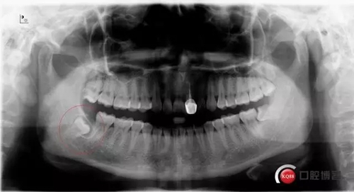 1.webp.jpg 1.webp.jpg