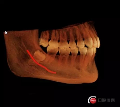 5.webp.jpg 5.webp.jpg