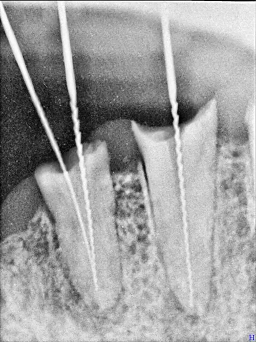 6.webp.jpg 6.webp.jpg