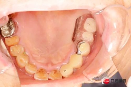 11.webp.jpg 11.webp.jpg