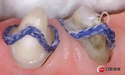 7.webp.jpg 7.webp.jpg