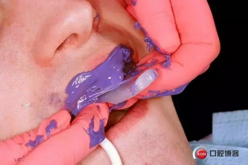 15.webp.jpg 15.webp.jpg