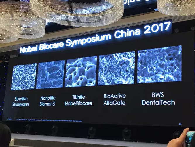 病例分享|復合樹脂微創(chuàng)美學修復關(guān)閉上前牙間隙 病例分享|復合樹脂微創(chuàng)美學修復關(guān)閉上前牙間隙