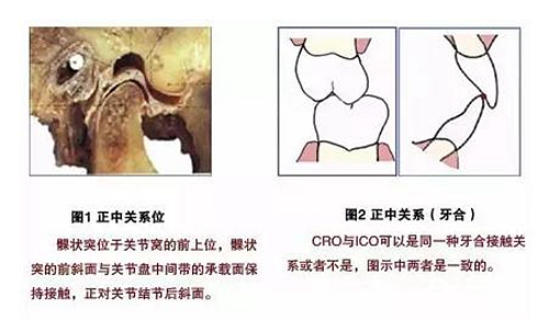 【臻美推薦】現(xiàn)代牙合學(xué)概念與全口固定義齒咬合重建 【臻美推薦】現(xiàn)代牙合學(xué)概念與全口固定義齒咬合重建