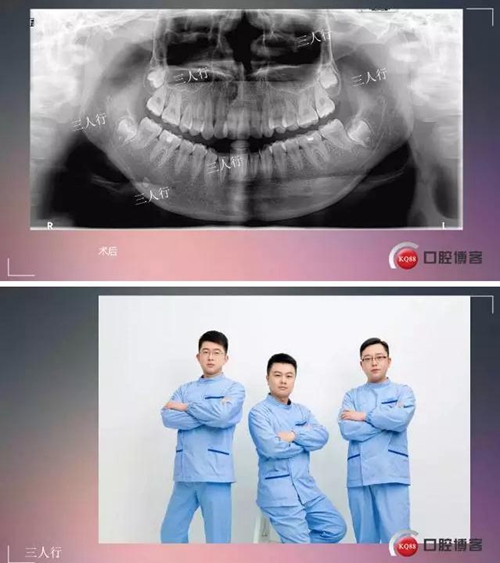 深部埋伏多生牙——微創(chuàng)處理 深部埋伏多生牙——微創(chuàng)處理