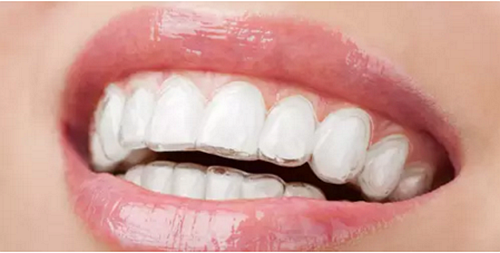 正畸流程(拔牙) 正畸流程(拔牙)