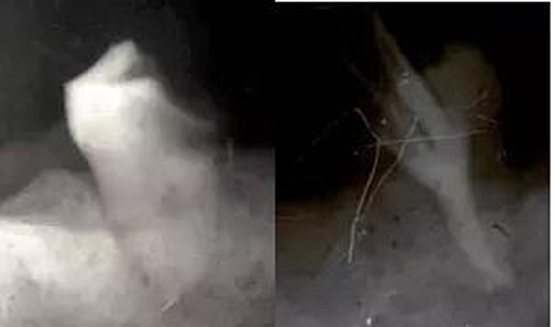 根管治療圖譜 根管治療圖譜