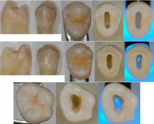 各牙齒的大概的開髓形態(tài) 各牙齒的大概的開髓形態(tài)