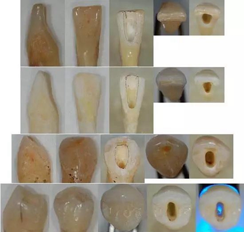 各牙齒的大概的開髓形態(tài) 各牙齒的大概的開髓形態(tài)