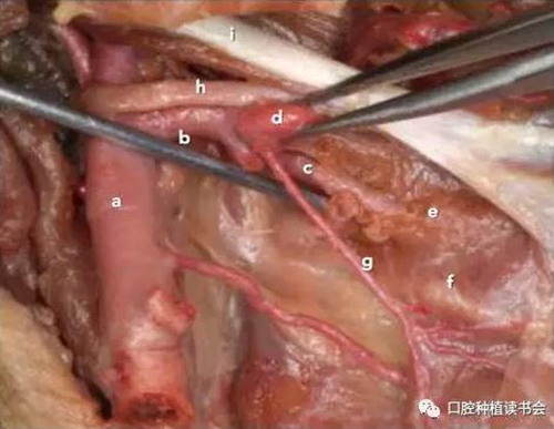 與骨增量相關(guān)的下頜區(qū)域解剖標(biāo)志(1) 與骨增量相關(guān)的下頜區(qū)域解剖標(biāo)志(1)