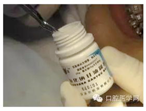 鄰面去釉的操作與注意事項(xiàng) 鄰面去釉的操作與注意事項(xiàng)