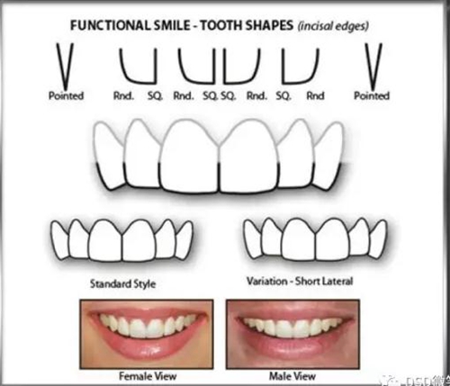 美學(xué)知識(shí)分享--切緣形態(tài)分類 美學(xué)知識(shí)分享--切緣形態(tài)分類