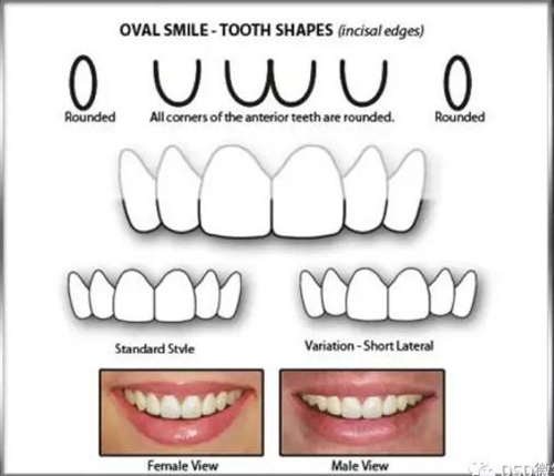 美學(xué)知識(shí)分享--切緣形態(tài)分類 美學(xué)知識(shí)分享--切緣形態(tài)分類
