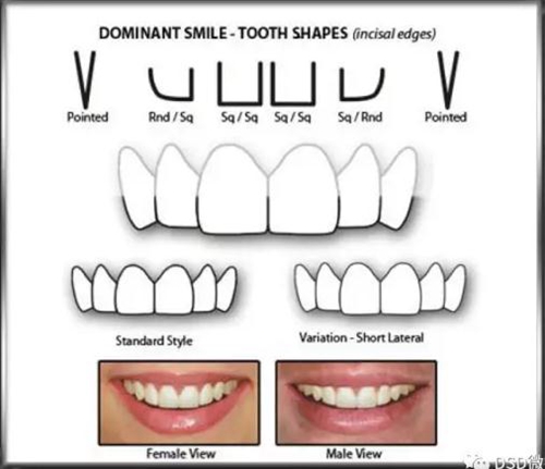 美學(xué)知識(shí)分享--切緣形態(tài)分類 美學(xué)知識(shí)分享--切緣形態(tài)分類