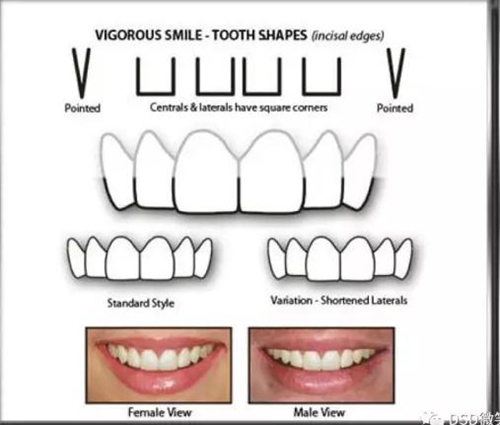 美學(xué)知識(shí)分享--切緣形態(tài)分類 美學(xué)知識(shí)分享--切緣形態(tài)分類