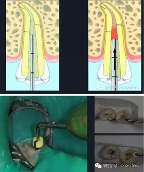 新熱熔充填系統(tǒng)C-Fill 新熱熔充填系統(tǒng)C-Fill