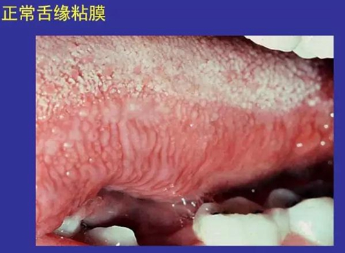 正?？谇火つぜ俺Ｒ姴p圖