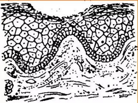 正常口腔黏膜及常見病損圖