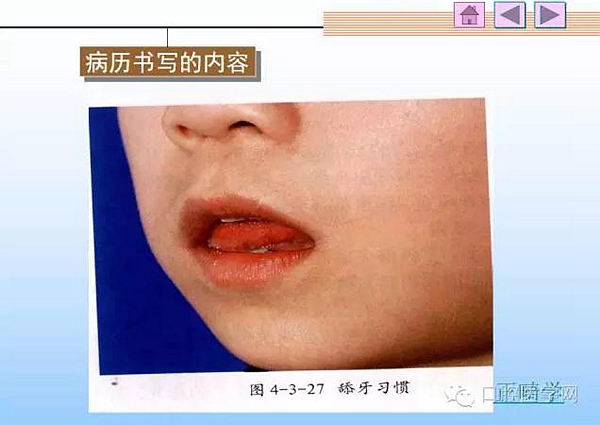 口腔正畸學病歷書寫 口腔正畸學病歷書寫