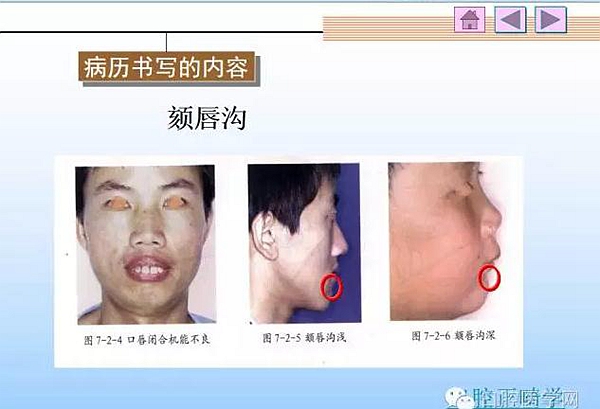 口腔正畸學病歷書寫 口腔正畸學病歷書寫