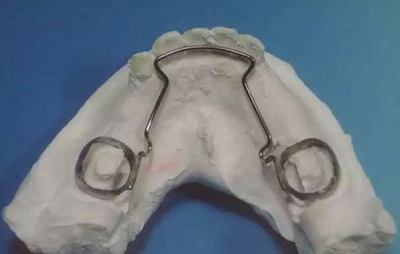 間隙保持器的應(yīng)用 間隙保持器的應(yīng)用